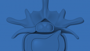 Lumbar-Discs